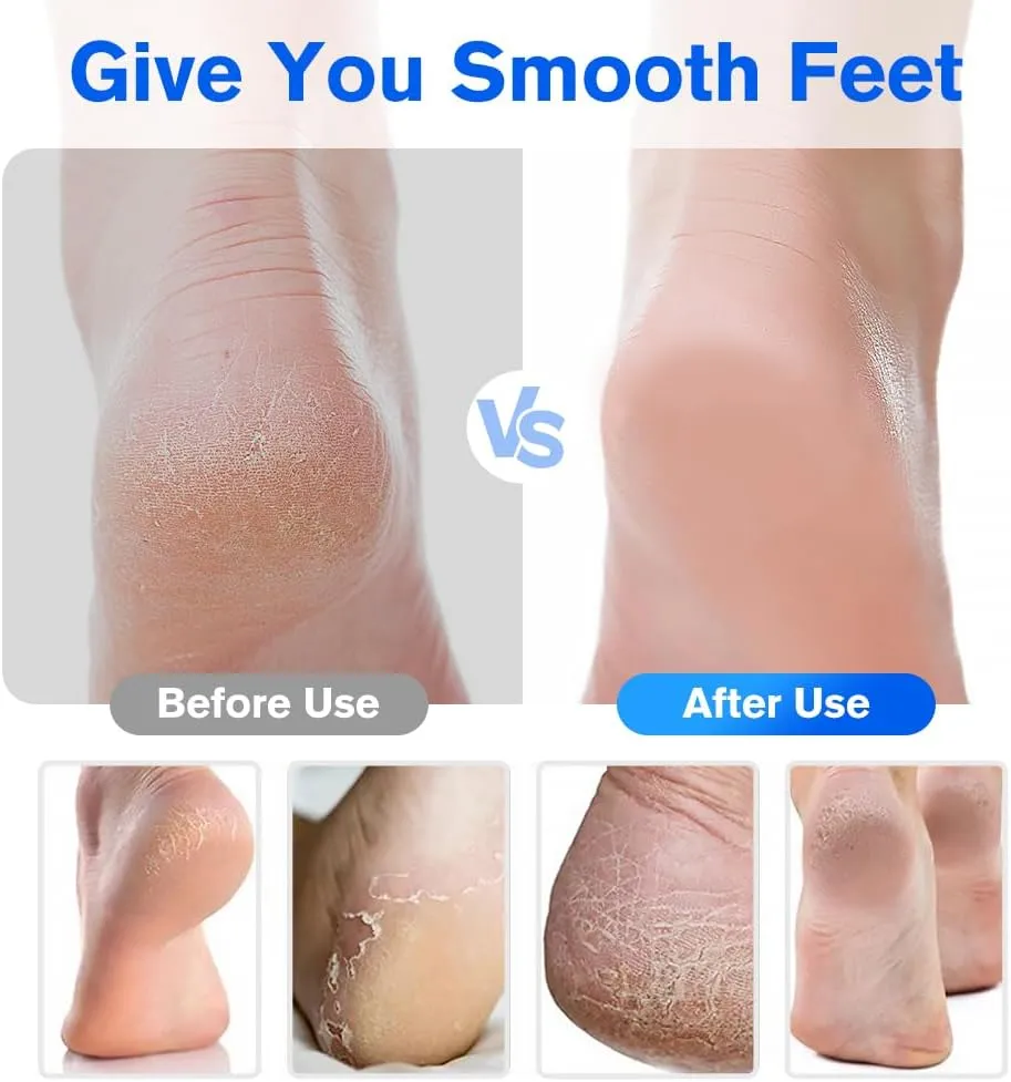 Veinsgrain Foot File, 2025 New Veins Grain Foot File,Nano Glass Foot File Callus Remover,Pedicure Tool for Smooth, Foot File for Rough Dead Skin Removal Callus (Gold Blue)
